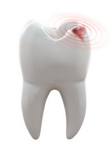 Tooth fillings  | American Fork Dental Center
